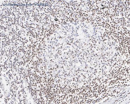 HUABIO HA722025 image 2