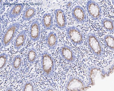 HUABIO HA722052 image 3