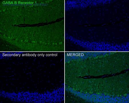 HUABIO HA722053 image 2