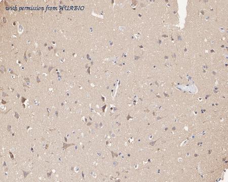 HUABIO HA722055 image 2