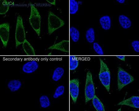 HUABIO HA722058 image 3