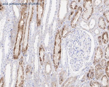 HUABIO HA722064 image 2