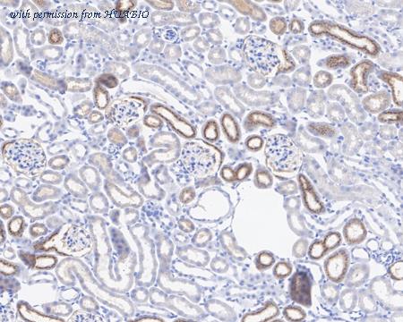 HUABIO HA722064 image 3