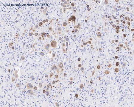 HUABIO HA722092 image 3