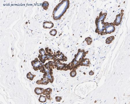 HUABIO HA722094 image 1