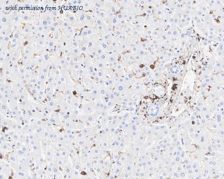 HUABIO HA722094 image 3