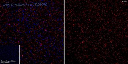 HUABIO HA722133 image 1