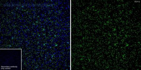 HUABIO HA722133 image 3