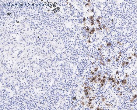 HUABIO HA722159 image 2