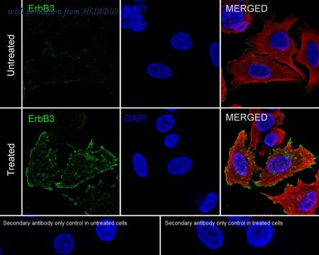 HUABIO HA722178 image 2