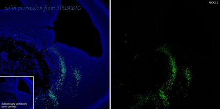 HUABIO HA722185 image 1