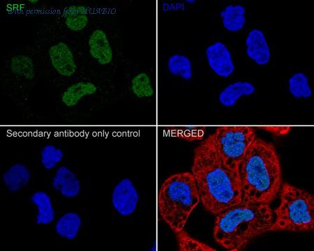 HUABIO HA722220 image 2