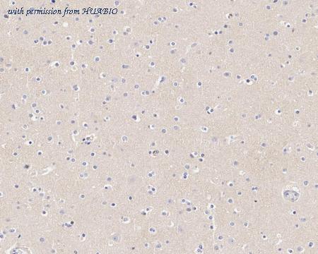 HUABIO HA722271 image 2