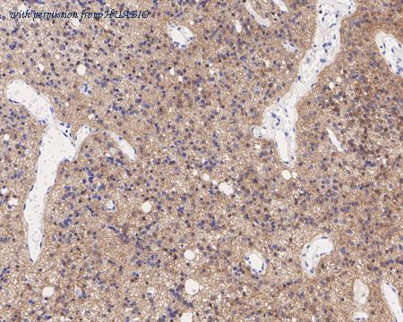 HUABIO HA722273 image 2