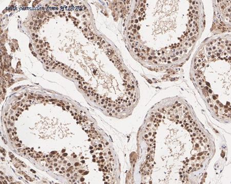 HUABIO HA722276 image 3