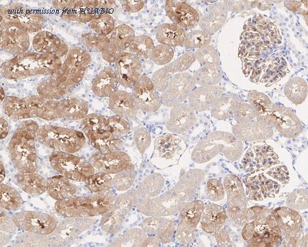 HUABIO HA722288 image 3