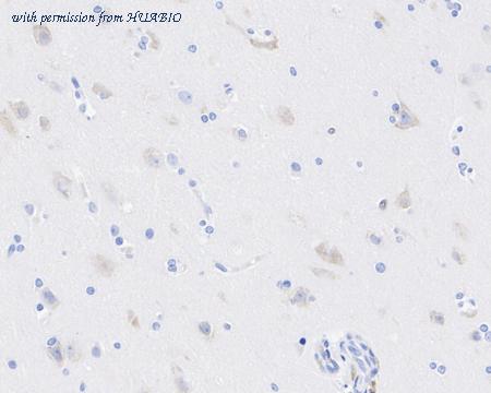 HUABIO HA722326 image 2