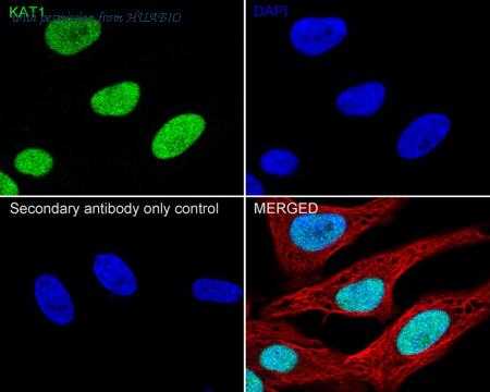 HUABIO HA722332 image 2