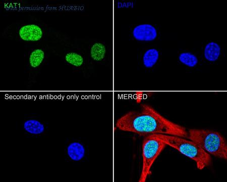 HUABIO HA722332 image 3