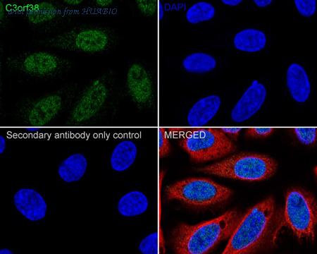 HUABIO HA722360 image 2