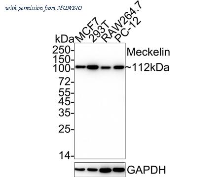 HUABIO HA722366 image 1