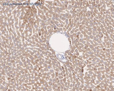 HUABIO HA722366 image 3