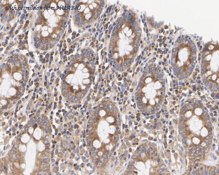 HUABIO HA722372 image 3