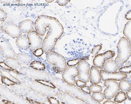 HUABIO HA722408 image 3