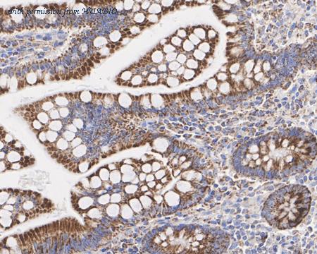 HUABIO HA722416 image 3