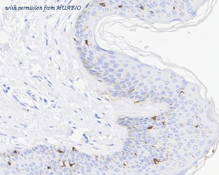 HUABIO HA722427 image 2