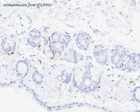 HUABIO HA722427 image 3