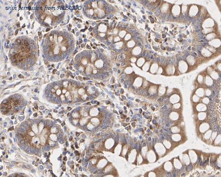 HUABIO HA722431 image 3