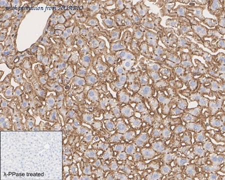 HUABIO HA722440 image 2