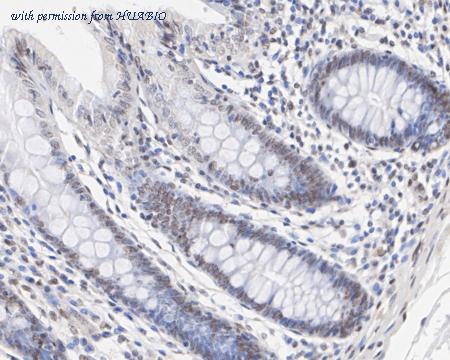 HUABIO HA722462 image 2