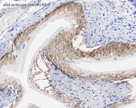 HUABIO HA722469 image 3