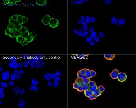 HUABIO HA722473 image 2