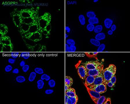 HUABIO HA722500 image 2