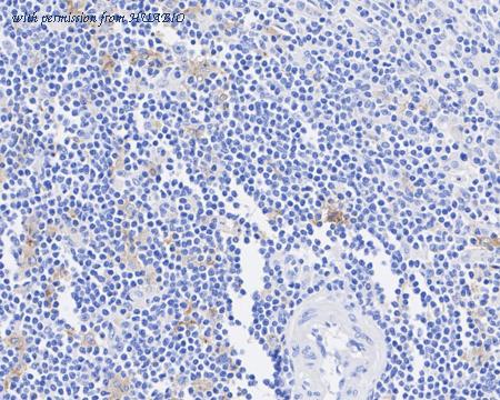 HUABIO HA722502 image 3