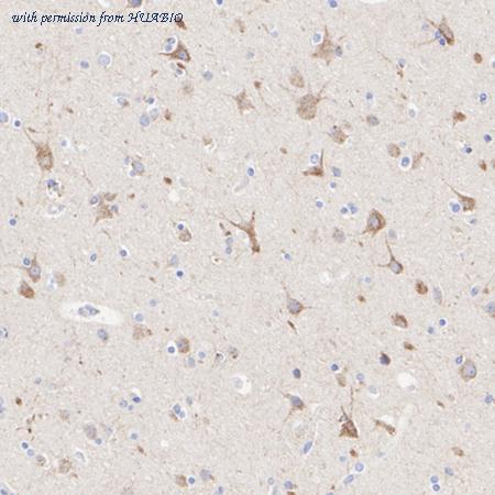 HUABIO HA722513 image 3