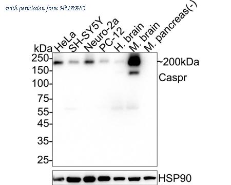 HUABIO HA722531 image 1