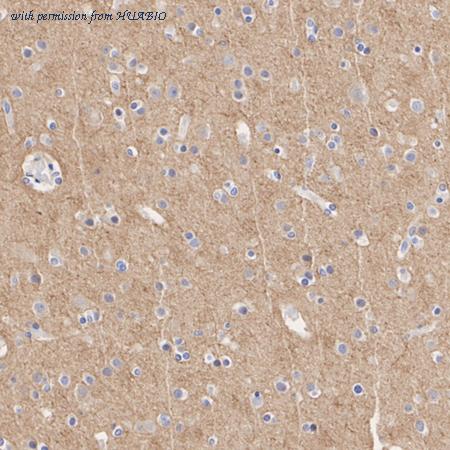 HUABIO HA722531 image 3