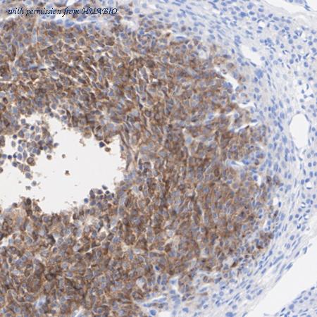 HUABIO HA722532 image 3