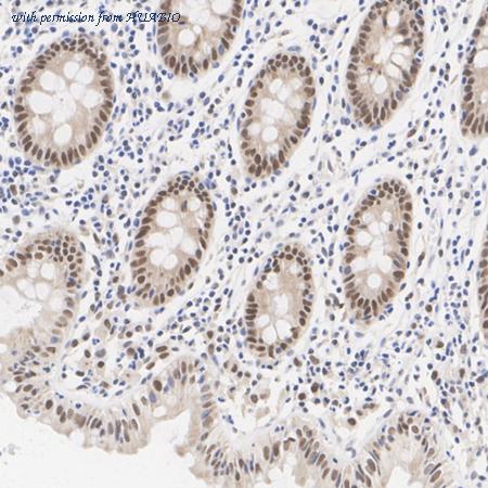 HUABIO HA722536 image 2