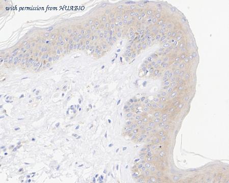 HUABIO HA722560 image 2