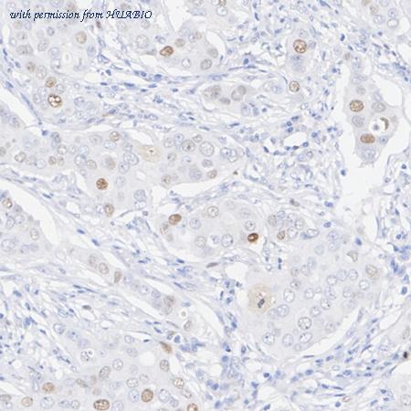 HUABIO HA722685 image 3