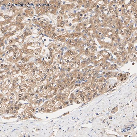 HUABIO HA722696 image 3