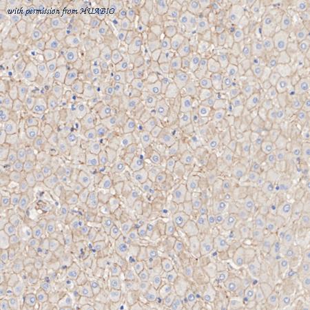 HUABIO HA722705 image 3