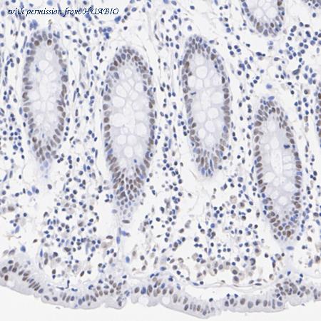 HUABIO HA722723 image 3