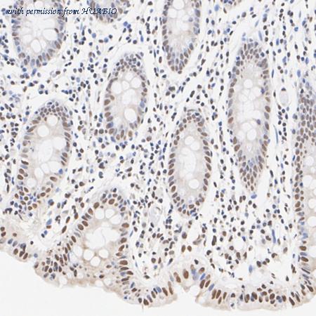 HUABIO HA722726 image 2