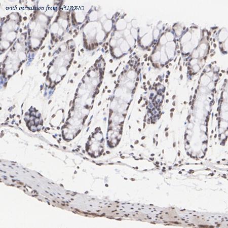 HUABIO HA722747 image 2